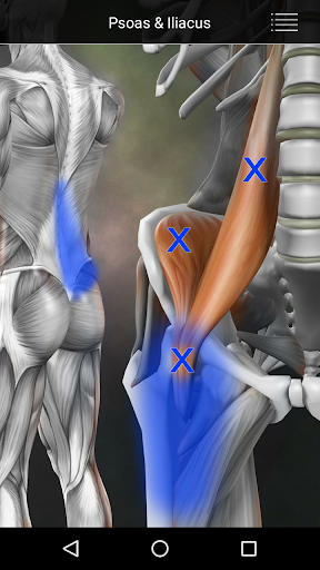 Muscle Trigger Point Anatomy screenshot