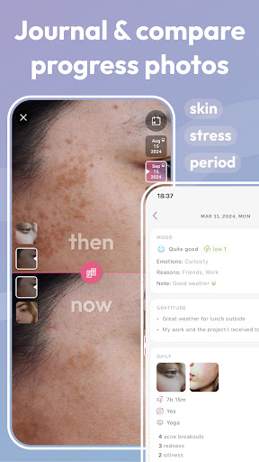 Skincare Routine: FeelinMySkin screenshot