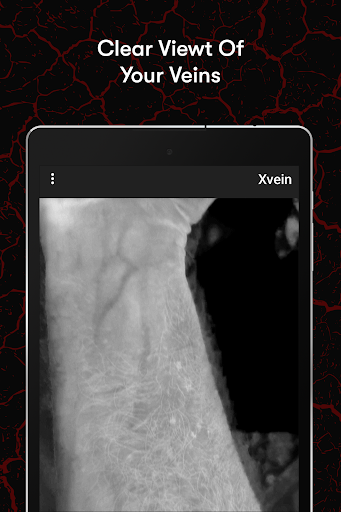 X-Vein screenshot