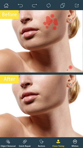 Photo Retouch- Object Removal screenshot