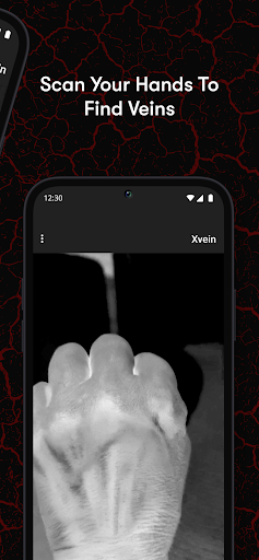 X-Vein screenshot