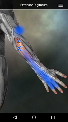 Muscle Trigger Point Anatomy screenshot