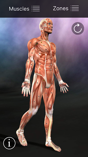 Muscle Trigger Point Anatomy screenshot