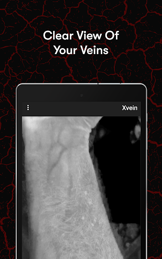 X-Vein screenshot