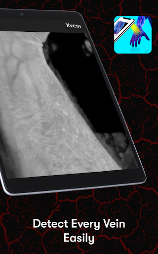 X-Vein screenshot